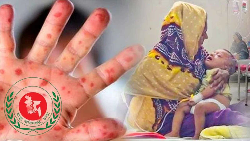 হাম উপসর্গে আরও ৮ জনের মৃত্যু