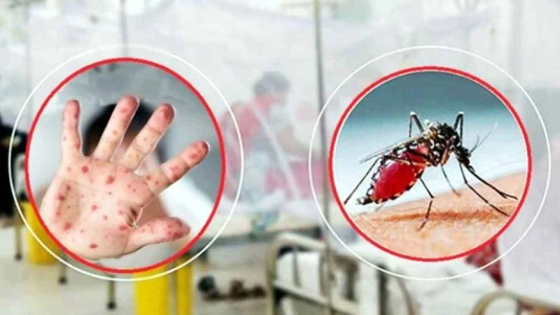 ২৪ ঘণ্টায় হাম উপসর্গে ৭ ও ডেঙ্গুতে ৬ জনের মৃত্যু